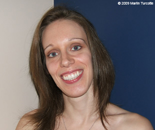 Marie-Hélène Cyr - After orthodontic treatments and orthognathic surgeries (November 28, 2009)